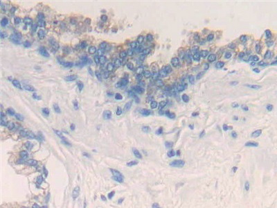 Polyclonal Antibody to Interleukin 20 (IL20)