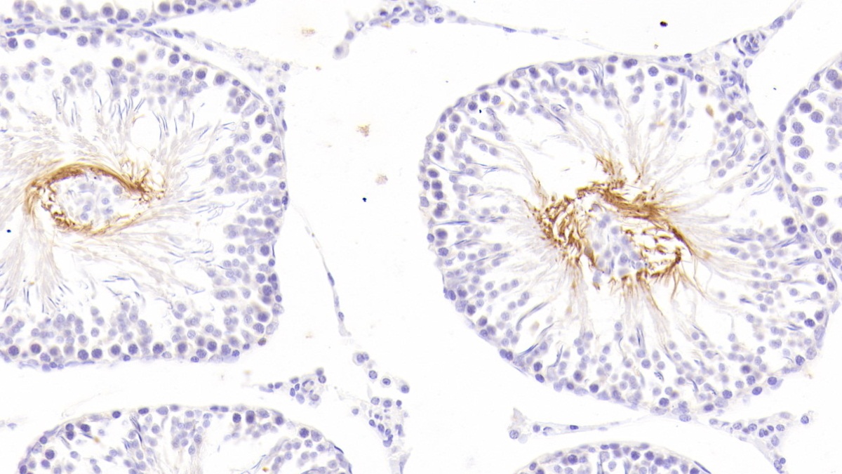 Polyclonal Antibody to Fibroblast Growth Factor Receptor Substrate 2 (FRS2)