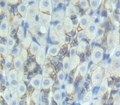 Polyclonal Antibody to Dual Oxidase 2 (DUOX2)