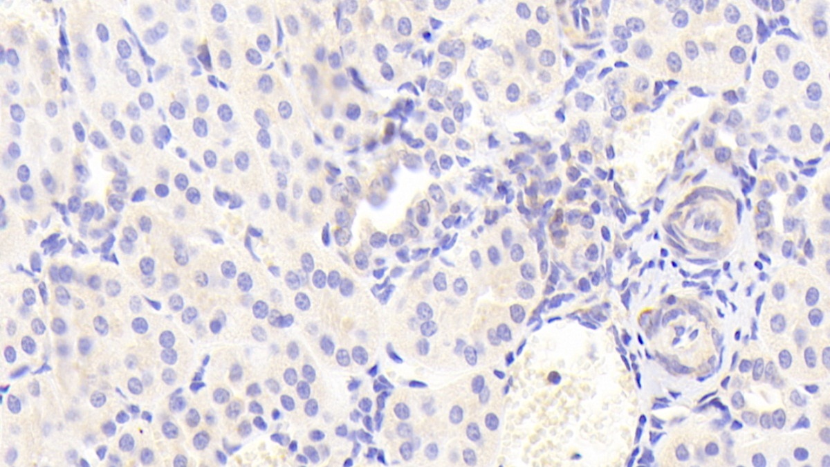 Polyclonal Antibody to Interferon Inducible T-Cell Alpha Chemoattractant (ITaC)