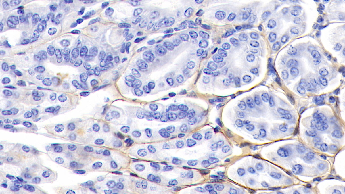 Polyclonal Antibody to Laminin Gamma 1 (LAMC1)