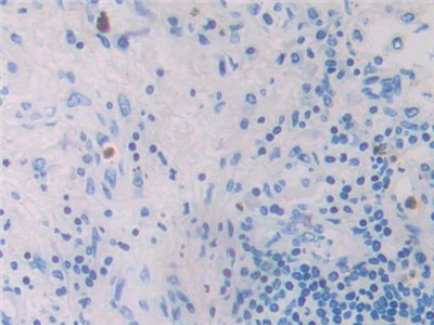 Polyclonal Antibody to Macrophage Inflammatory Protein 4 Alpha (MIP4a)