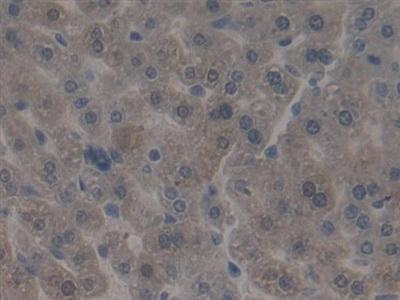 Polyclonal Antibody to Integrin Beta 5 (ITGb5)