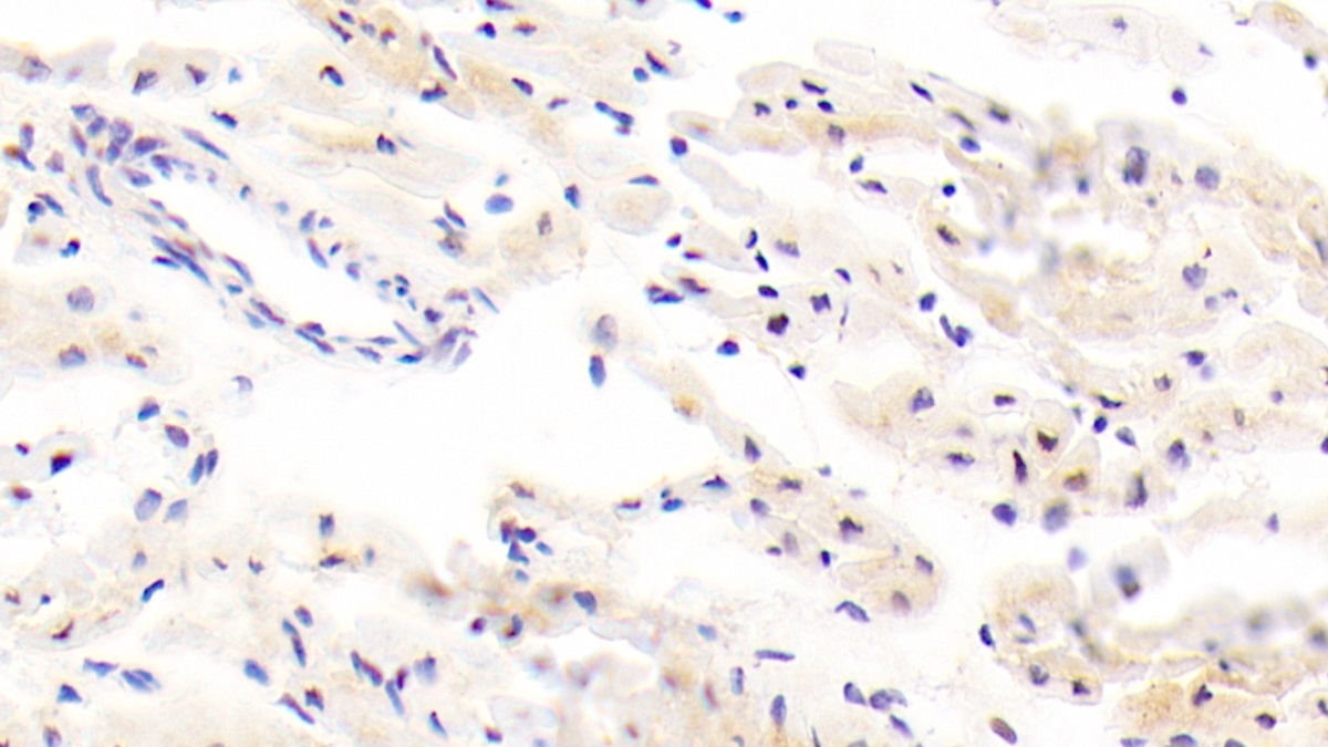 Polyclonal Antibody to Integrin Beta 8 (ITGb8)