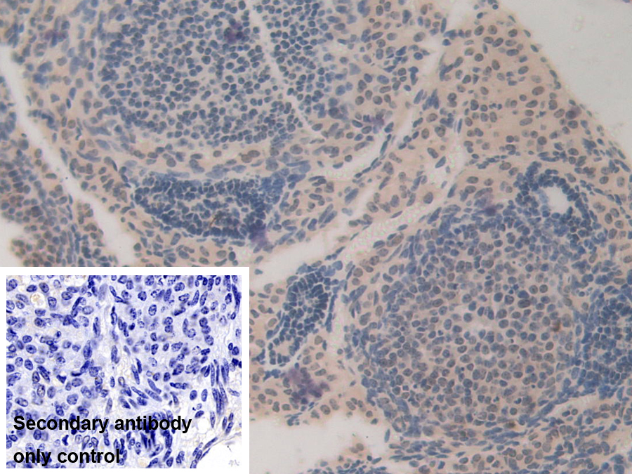 Polyclonal Antibody to Bone Morphogenetic Protein 15 (BMP15)