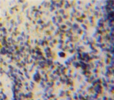 Polyclonal Antibody to Growth Differentiation Factor 3 (GDF3)