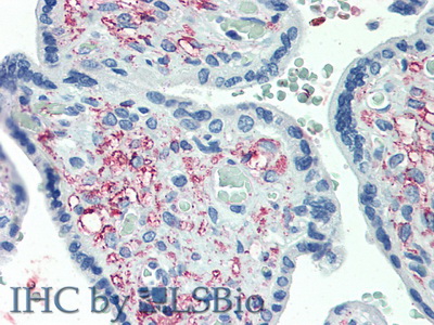 Polyclonal Antibody to Growth Differentiation Factor 11 (GDF11)