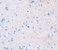 Polyclonal Antibody to Growth Differentiation Factor 10 (GDF10)