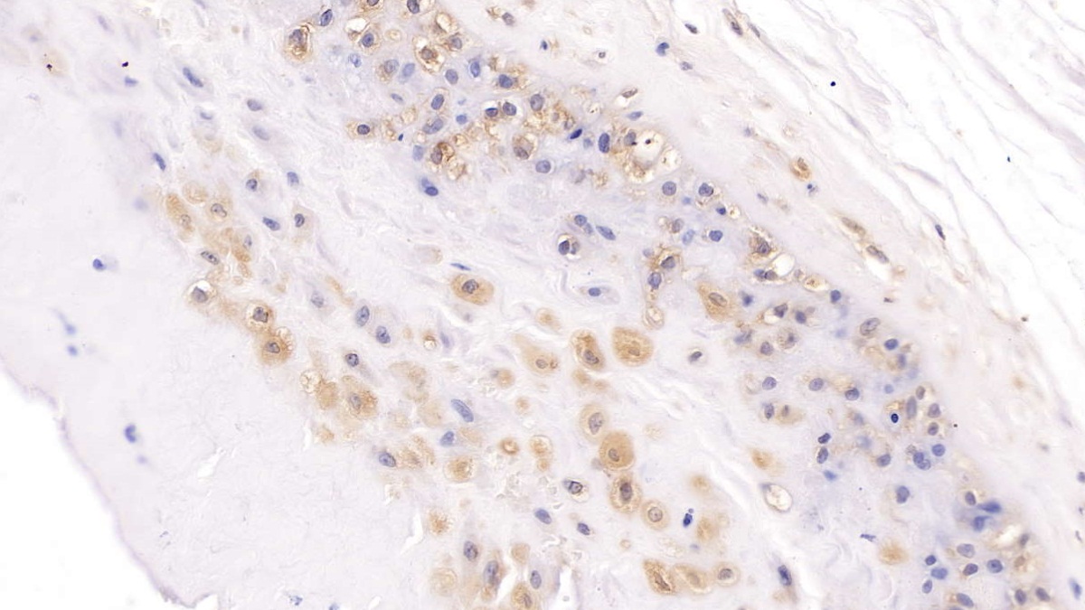 Polyclonal Antibody to Noggin (NOG)