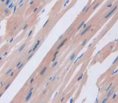 Polyclonal Antibody to Noggin (NOG)