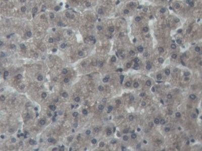 Polyclonal Antibody to Noggin (NOG)