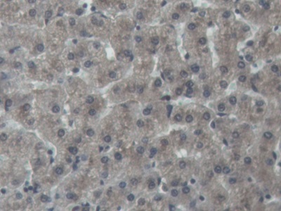 Polyclonal Antibody to Noggin (NOG)