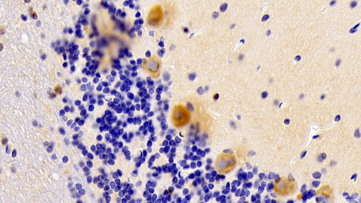 Polyclonal Antibody to Noggin (NOG)