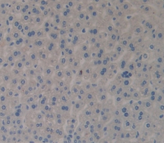 Polyclonal Antibody to Collagen Type X (COL10)