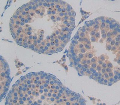 Polyclonal Antibody to Glia Maturation Factor Beta (GMFb)