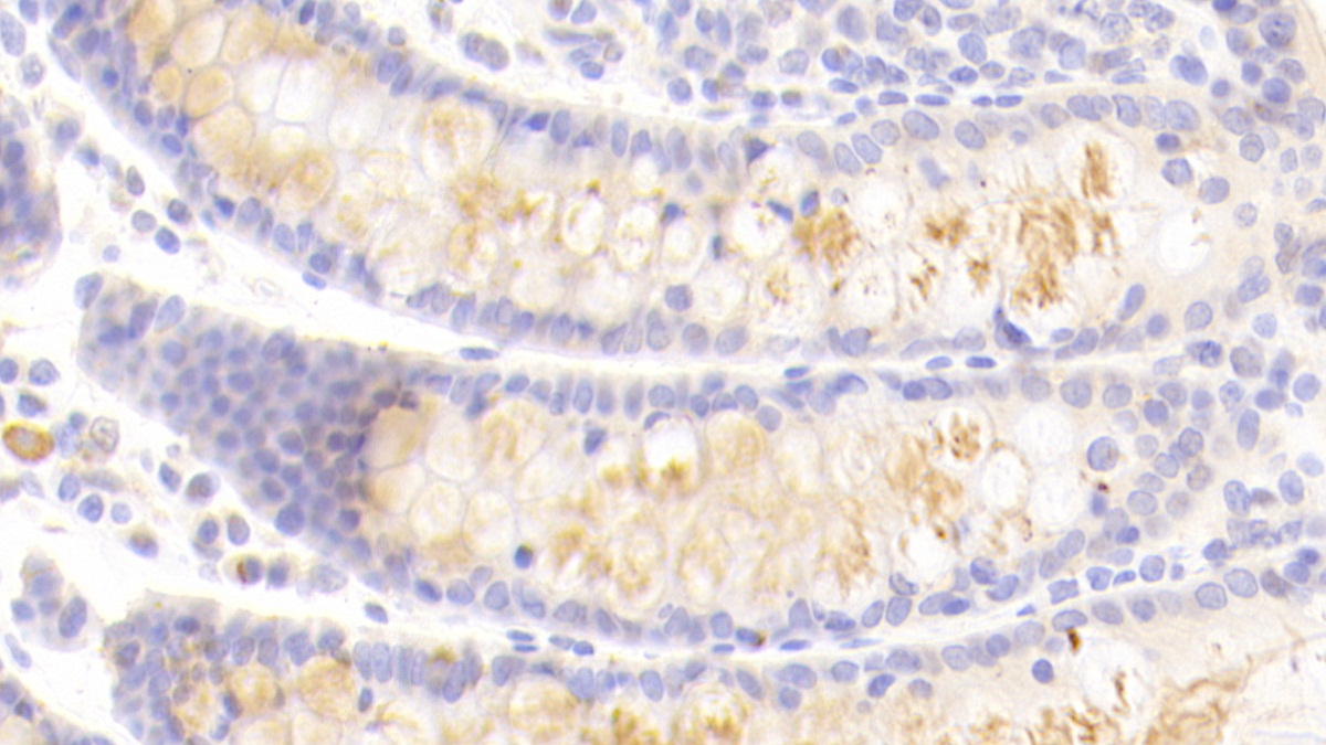 Polyclonal Antibody to Left/Right Determination Factor 1 (LEFTY1)