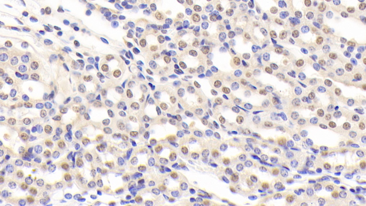 Polyclonal Antibody to Nucleolin (NCL)