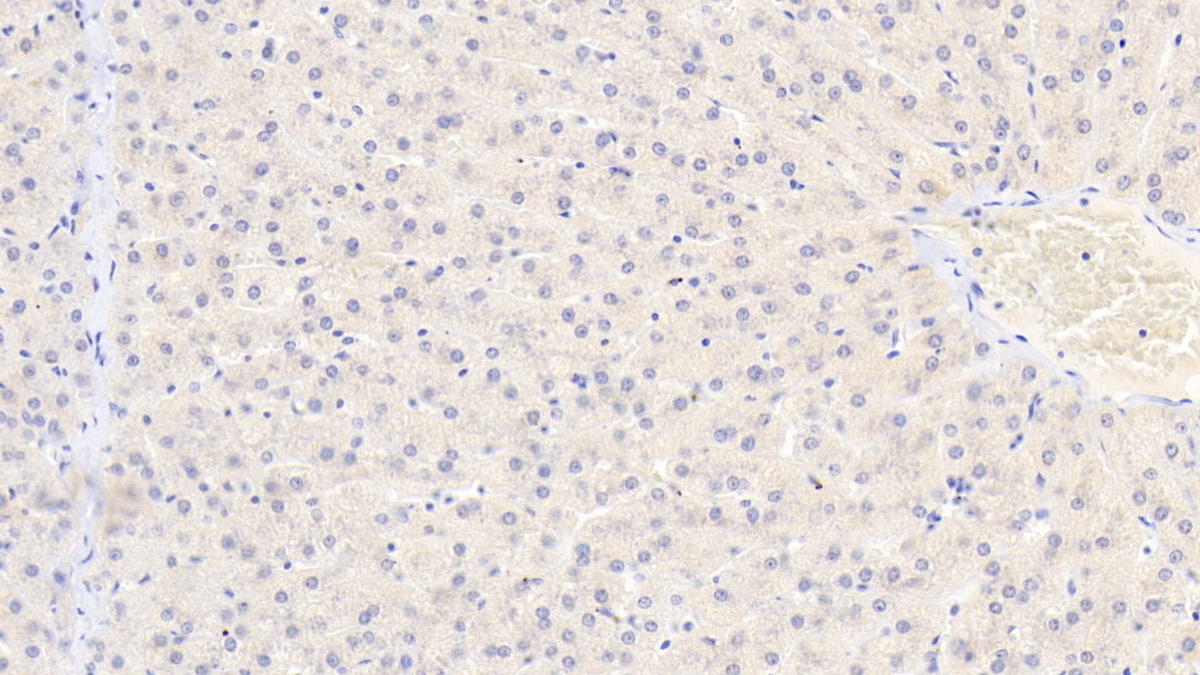 Polyclonal Antibody to Phosphoinositide Dependent Protein Kinase 1 (PDPK1)