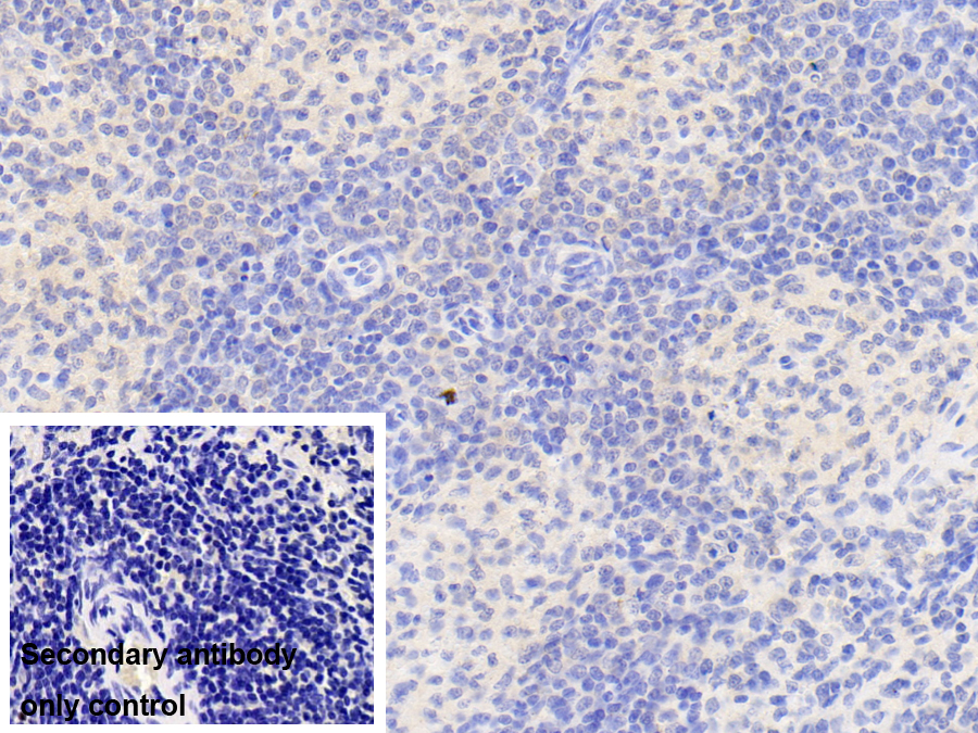 Polyclonal Antibody to Nuclear Receptor Subfamily 0,Group B,Member 2 (NR0B2)