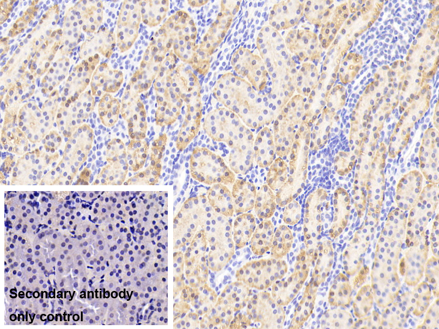 Polyclonal Antibody to Aminoacylase 1 (ACY1)