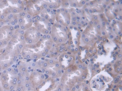 Polyclonal Antibody to Alpha Adducin (ADD1)