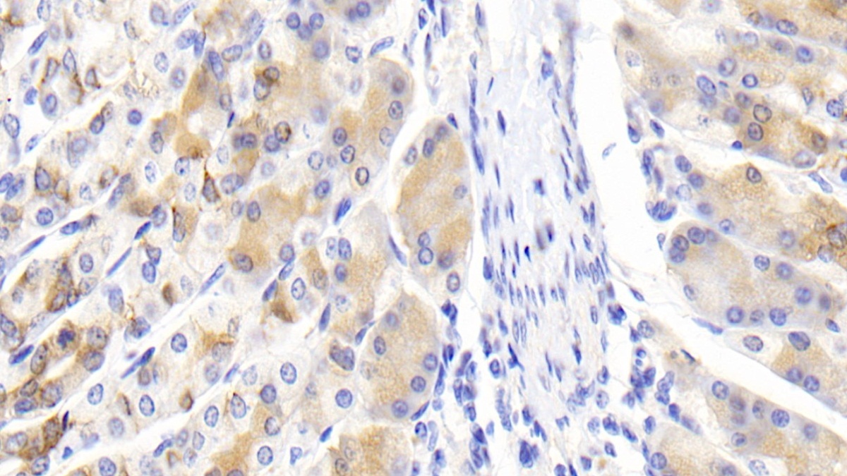 Polyclonal Antibody to Anterior Gradient 2 (AGR2)