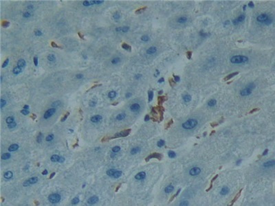 Polyclonal Antibody to Allograft inflammatory factor 1 (AIF1)