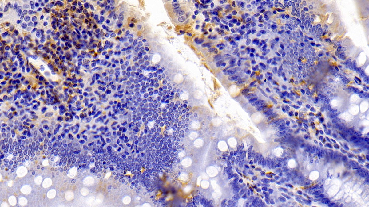 Polyclonal Antibody to Ionized Calcium-binding Adapter Molecule 1 (IBA1)