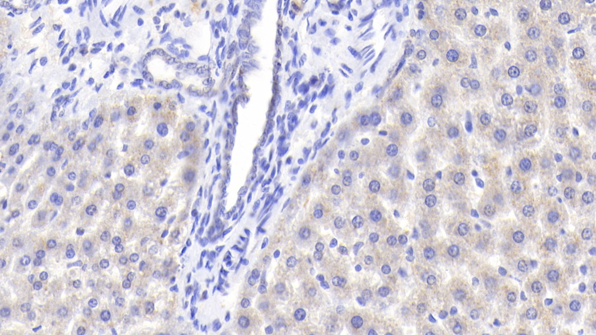 Polyclonal Antibody to Apolipoprotein M (APOM)