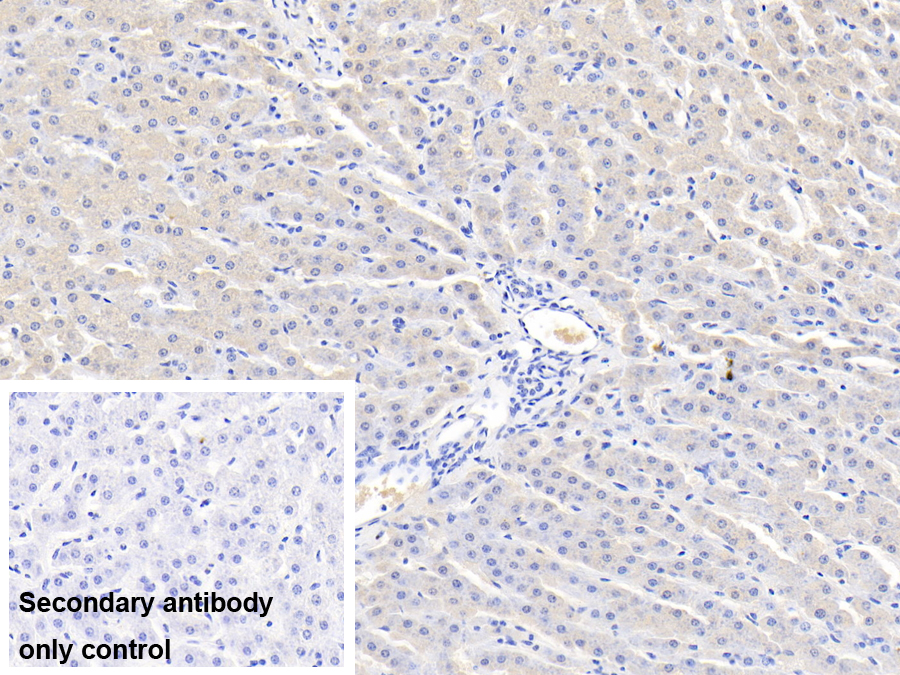 Polyclonal Antibody to Antithrombin (AT)