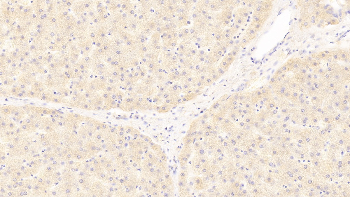 Polyclonal Antibody to Antithrombin (AT)