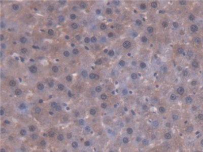 Polyclonal Antibody to Antithrombin (AT)