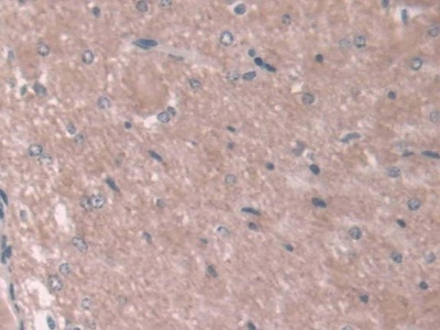 Polyclonal Antibody to Asporin (ASPN)