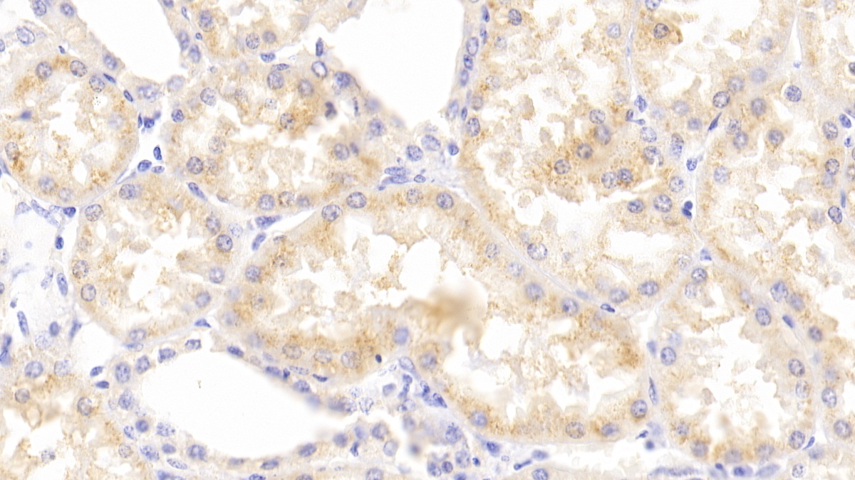 Polyclonal Antibody to Breakpoint Cluster Region (BCR)