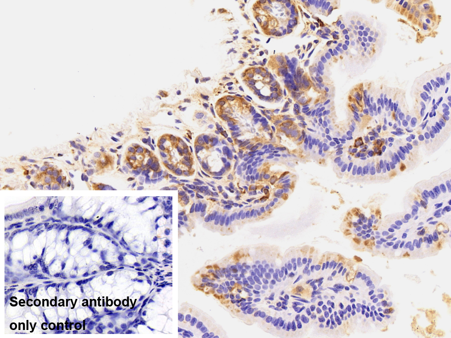 Polyclonal Antibody to Heat Shock 70kDa Protein 5 (HSPA5)