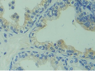 Polyclonal Antibody to Calcyphosine (CAPS)