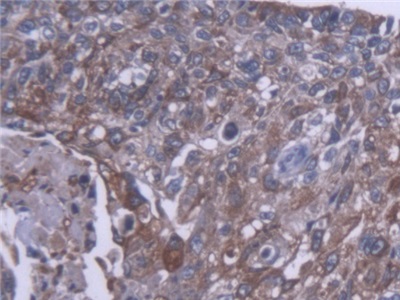 Polyclonal Antibody to Carboxylesterase 1 (CES1)