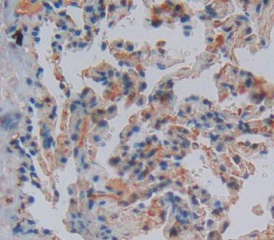 Polyclonal Antibody to Cysteine Rich Protein 1, Intestinal (CRIP1)