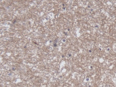 Polyclonal Antibody to Collapsin Response Mediator Protein 1 (CRMP1)