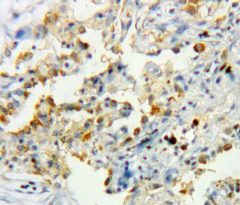 Polyclonal Antibody to Catalase (CAT)