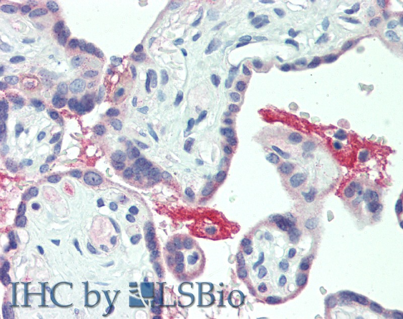 Polyclonal Antibody to Extracellular Matrix Protein 1 (ECM1)