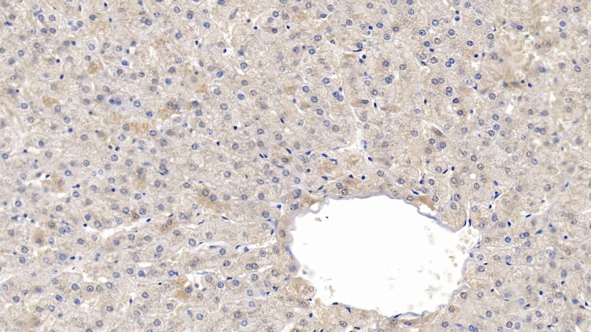 Polyclonal Antibody to Fatty Acid Synthase (FASN)