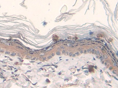 Polyclonal Antibody to Fatty Acid Synthase (FASN)