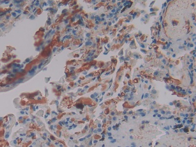 Polyclonal Antibody to Fibrinogen Gamma (FGg)