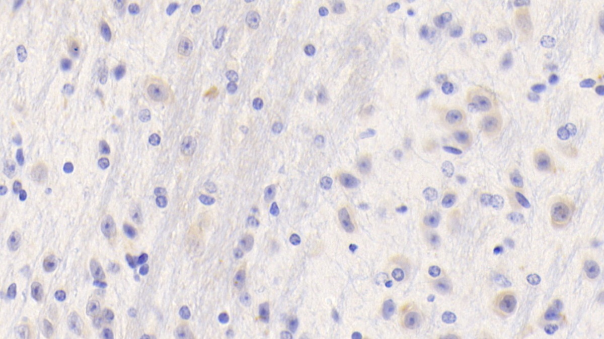 Polyclonal Antibody to Fibrinogen Gamma (FGg)