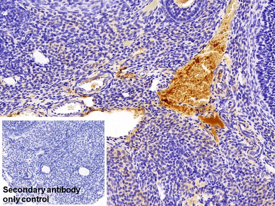 Polyclonal Antibody to Fibrinogen Gamma (FGg)