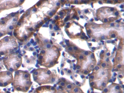 Polyclonal Antibody to Ferroportin (FPN)