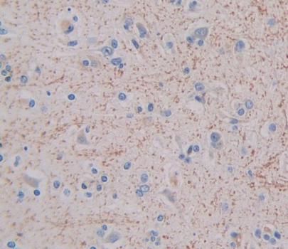 Polyclonal Antibody to Growth Hormone Releasing Hormone Receptor (GHRHR)