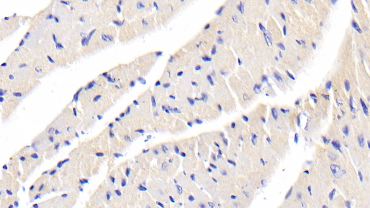 Polyclonal Antibody to Heart And Neural Crest Derivatives Expressed Protein 1 (HAND1)