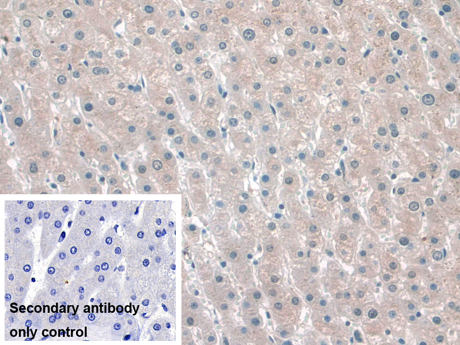 Polyclonal Antibody to Katanin P60 Subunit A 1 (KATNA1)